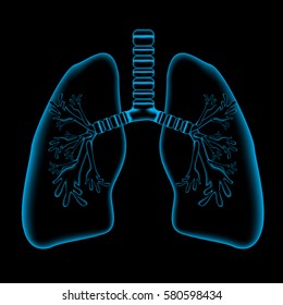 Lungs pain, Lungs x ray