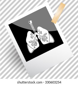 lungs. Photoframe. Vector icon.