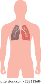 Lungs of a sick person sick lungs with a trachea on a human background vector illustration