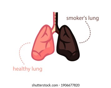 3,348 Tar in lungs Images, Stock Photos & Vectors | Shutterstock