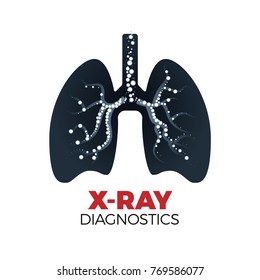 Lungs x-ray diagnostics vector concept. Tuberculosis or cancer prevention. Illustration of lungs silhouette filled with radiated round shapes. Isolated on white background.