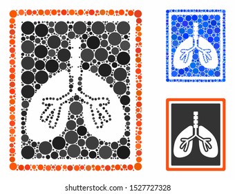 Lungs x-ray photo composition of small circles in variable sizes and shades, based on lungs x-ray photo icon. Vector random circles are organized into blue composition.