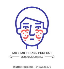 Lupus rash two color line icon. Erythema chronic illness. Life expectancy disorder. Immune system treatment bicolor outline symbol. Duotone linear pictogram. Isolated illustration. Editable stroke
