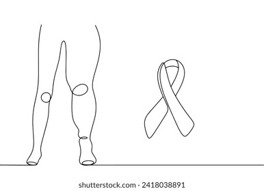 Lymphedema is an incurable disease. Damage to the lower extremities. Healthy leg and leg with lymphedema. Vector illustration. Images produced without the use of any form of AI software at any stage. 