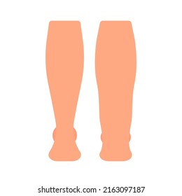 Lymphedema leg, health and disease feet, lymphoedema and lymphatic edema. Lymphatic system dysfunction. Elephantiasis, legs swelling disease. Vector illustration