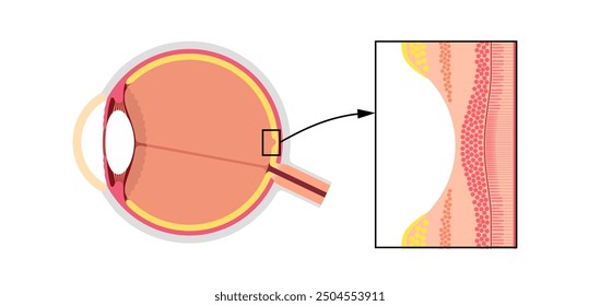 Macula fovea and foveola structure anatomy. Scheme of retina layer in the eye. Posterior portion of the eyeball. Photoreceptor, neuronal and glial cells, cones and rods diagram, vector illustration