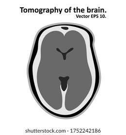 Magnetic Resonance Imaging Of The Brain. Cross Section Of The Brain With MRI / CT Scan. Vector EPS10.