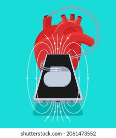 Magnets inside modern cell phones can potentially deactivates pacemakers or other implantable medical devices