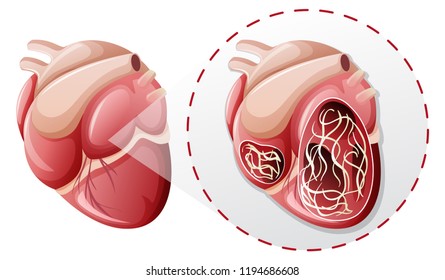 Magnified Heart Worm Concept Illustration