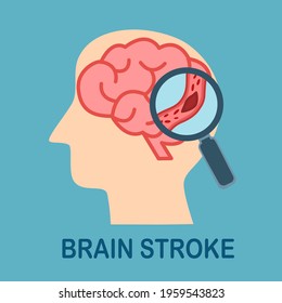 Magnifying human brain stroke problem in flat design. Brain disease. 