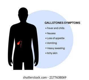 Main Gallstones Symptoms. Nausea, Vomiting, Loss Of Appetite, Fever And Diarrhea. Gallbladder Stones Disease Treatment. Digestive System Problems. Biliary Duct Anatomy Medical Vector Illustration.