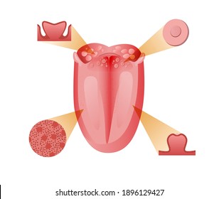 Main receptors and cells tongue. Basic bitter sensation receptor with schematic sour red sweet and salty flavor on soft anatomical vector papillae.