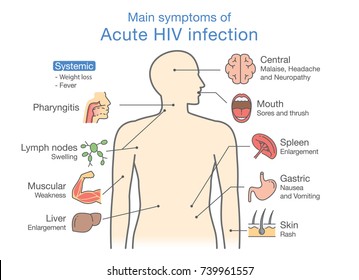 Main Symptom Acute HIV Infection. Illustration About Diagram For Patient.