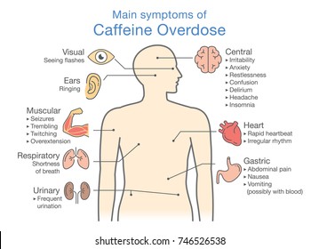 Main symptoms of Caffeine Overdose. Illustration about health check up diagram.
