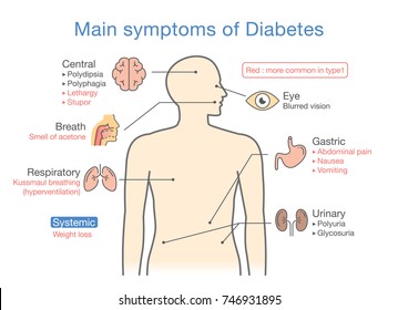 Main symptoms of Diabetes. Illustration about diagram for medical diagnosis of people disease.