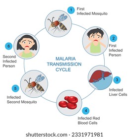 Malaria-Übertragungszyklus. Schritte von Infektionen bei Menschen mit Moskito.Infografik.
