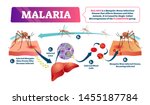 Malaria vector illustration. Labeled mosquito bite infected disease scheme. Blood cells illness caused by dangerous insects. Educational infographic cycle with liver poisonous wildlife infections.