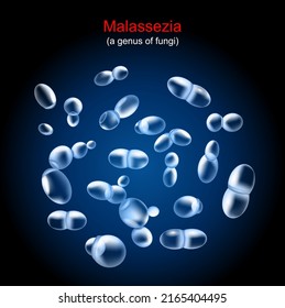 Malassezia. fungus that caused of Tinea versicolor, pityriasis and other skin disease. Close-up of yeast colony on dark background. realistic vector illustration