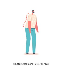 Male Character Wrong Standing Position with Bent Spine and Head Tilt. Bad Posture for Back Health, Spinal Curvature, Scoliosis Disease Isolated on White Background. Cartoon People Vector Illustration