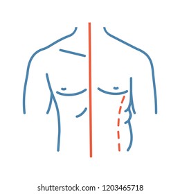 Male coolsculpting color icon. Flanks correction. Male liposuction and body contouring before and after. Plastic surgery. Isolated vector illustration