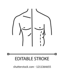 Male coolsculpting linear icon. Flanks correction. Male liposuction and body contouring before and after. Plastic surgery. Contour symbol. Vector isolated outline drawing. Editable stroke