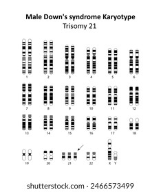 Male Down's syndrome (trisomy 21) human karyotype