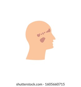 Male face with sinuses in different colors anatomical scheme isolated vector illustration on white background. Healthcare medical educational placard or banner element.