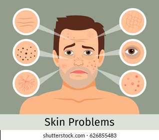 Male facial skin problems vector illustration. Acne and dark spots, wrinkles and circles under the eyes for cosmetics websites