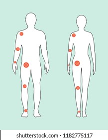 Male and female contour in full growth with a painful joints.  Vector illustration.