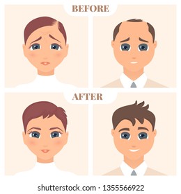 Male and female pattern hair loss set. Baldness treatment result in men and women. Before and after concept. Alopecia infographic medical vector template for clinics and diagnostics centres.