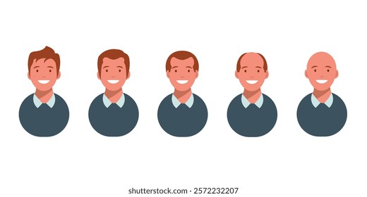 Male hair loss stages set. Top view portrait of a balding man. Baldness pattern scheme. Vector illustration.
