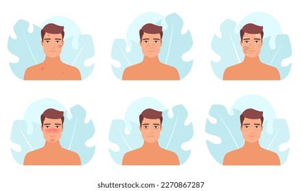 Male skin problem set vector illustration. Cartoon man with different types of medical troubles with skin collection, dark circle under eyes and wrinkles, acne and melasma, blackheads and rosacea