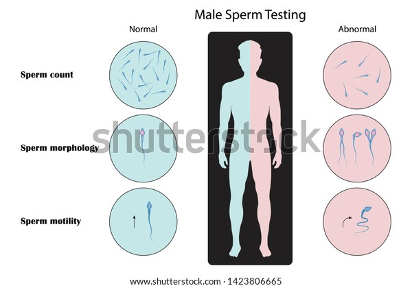 男性の精子検査分析 顕微鏡検査 ベクターイラストeps10 のベクター画像素材 ロイヤリティフリー