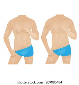 male torso, a man with a hairy chest and a man's body is smooth with no hair, men's hair removal