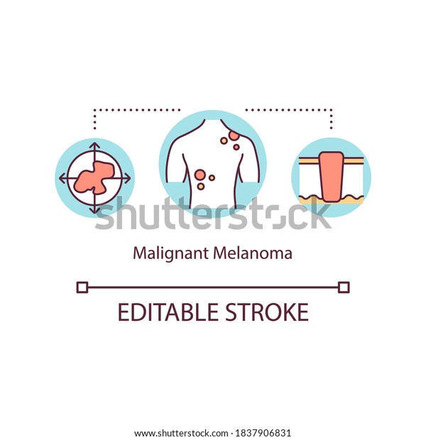 Malignant Melanoma Concept Icon Malignancy Treatment Stock Vector