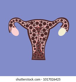 Malignant neoplasm arising from cells in the cervix uteri.