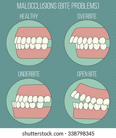 Malocclusion problems, bad bite infographic. Orthodontic set.