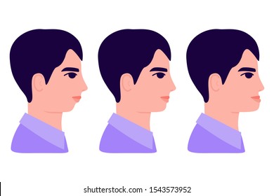 Malocclusion, young man in profile. Wrong bite: lower jaw extended forward and retracted. Bite correction with braces. Vector illustration