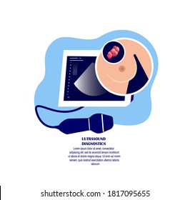 Mammology Ultrasound Diagnostics Sonographer,Examine Lacteal Gland,Cancer Swelling,Female Breast, Ultrasound Investigation.Digital Treatment.Research Female Curing.Medical Diagnostic Flat Illustration