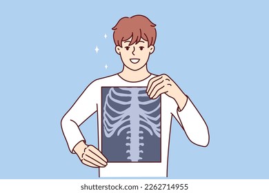 Man applies x-ray film to chest to prove absence of cancerous tumor or spinal injury. Guy with x-ray picture after fluorography procedure made under control of doctor radiologist in hospital 