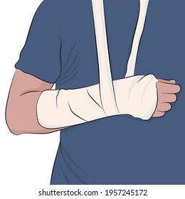 Man with arm in a cast and bandaged. White background.