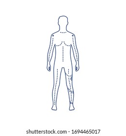 Man with artificial leg black line icon. Person who has a prosthesis instead of a real leg. Pictogram for web page, mobile app, promo. UI UX GUI design element. Editable stroke