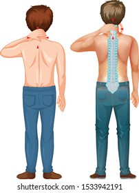 Man with back pain on white background illustration