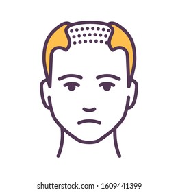 Man with a bald head color line icon. Baldness stage. Alopecia. Pictogram for web page, mobile app, promo. UI UX GUI design element. Editable stroke.