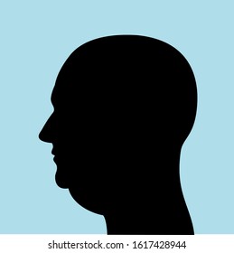 Man with bald head and double chin and submental fat - ugly and unhealthy appearance because of fat, obesity, overweight or illness and disease. Vector illustration. 