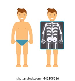 The man before and after X-ray. Flat Vector illustration isolated on white background