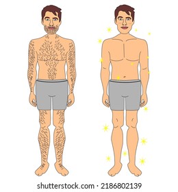 Man Depilation Treatment Illustration Detail