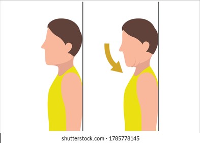 Man Doing Chin Tuck Stretches Poses Silhouette Flat Illustration Isolated On White Background In Different Poses - Physical Therapy