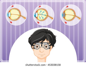 Mann mit Brille und Augenproblemen