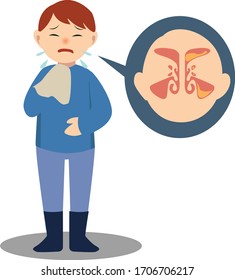 Ein Mann ist krank wegen Sinusitis-Illustration